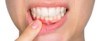 ¿Qué es la periodoncia y qué tipo de tratamientos hay?