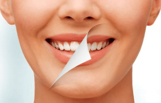 Estética dental en Estepona